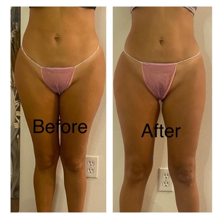 312458145_169780215705585_8331414094135225978_n