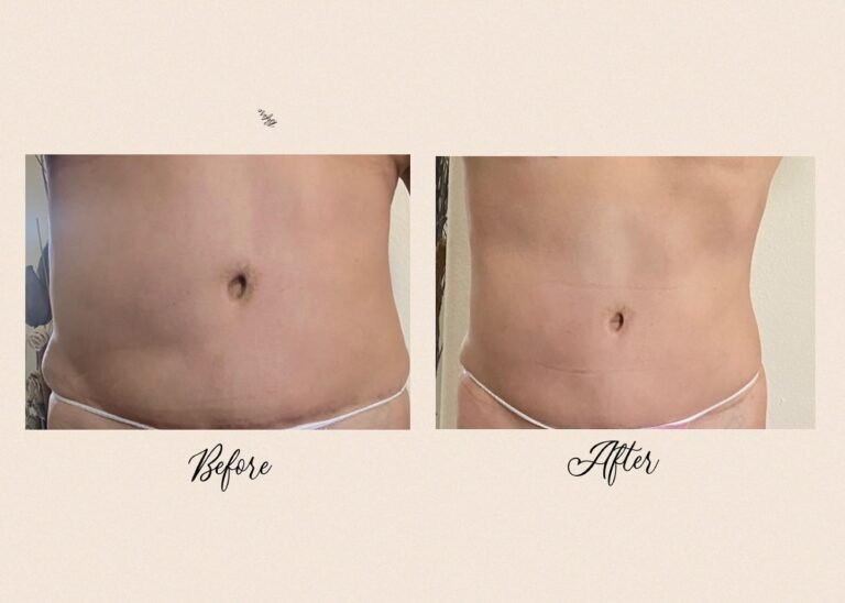 315235797_938314184222061_3166498800998774015_n