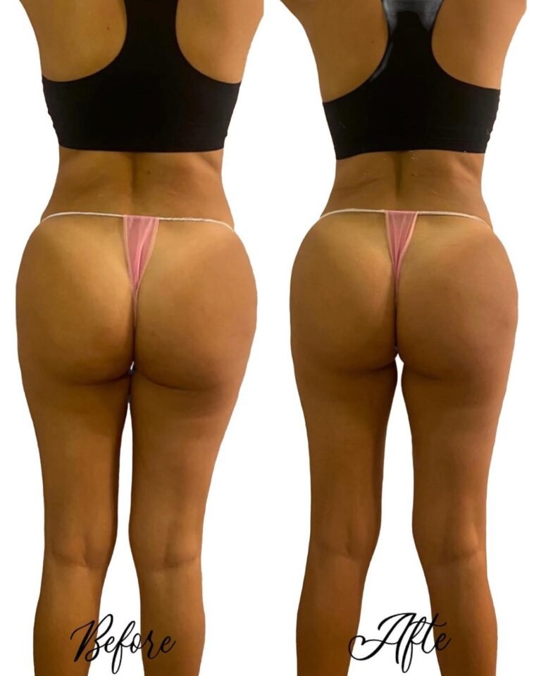 315470985_874306223584931_7330758708602458034_n